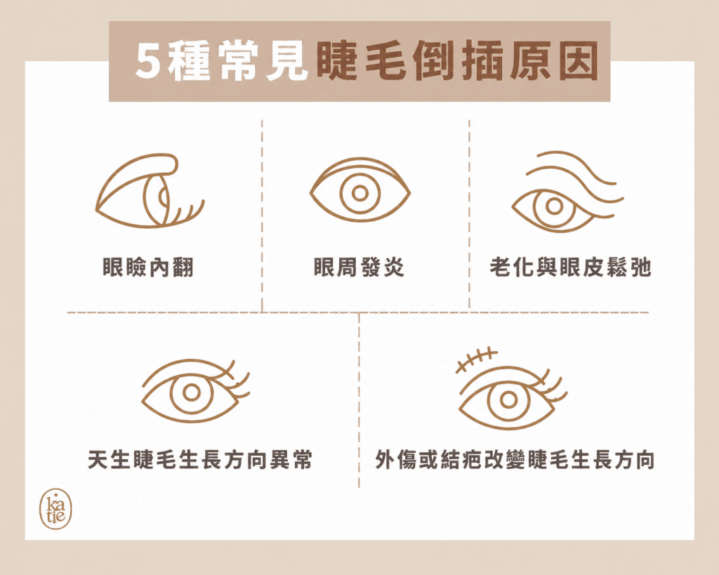 睫毛倒插原因有哪些?5種常見形成原因